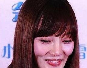明星整容露陷,露陷瞬间，美丽背后的代价