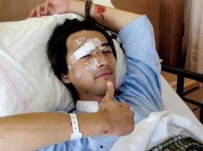 烧伤整容的明星,勇敢蜕变，重拾自信风采